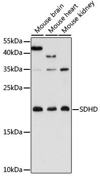 SDHD Polyclonal Antibody[29789