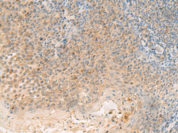 FBXO9 Antibody[47760]