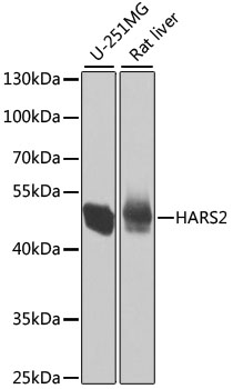 HARS2 Polyclonal Antibody[3133