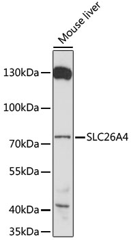 SLC26A4 Polyclonal Antibody[29