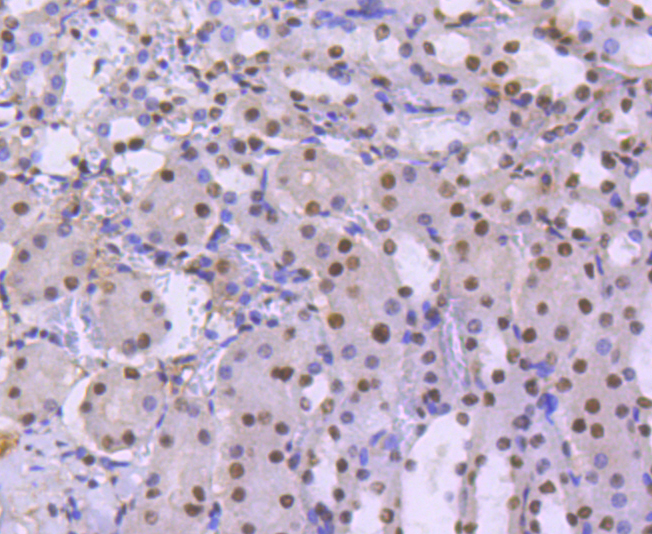 BRG1 Rabbit mAb[49101]