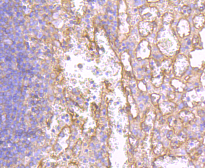 MHC class I Rabbit mAb[49361]