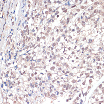 c-Jun Polyclonal Antibody[2908