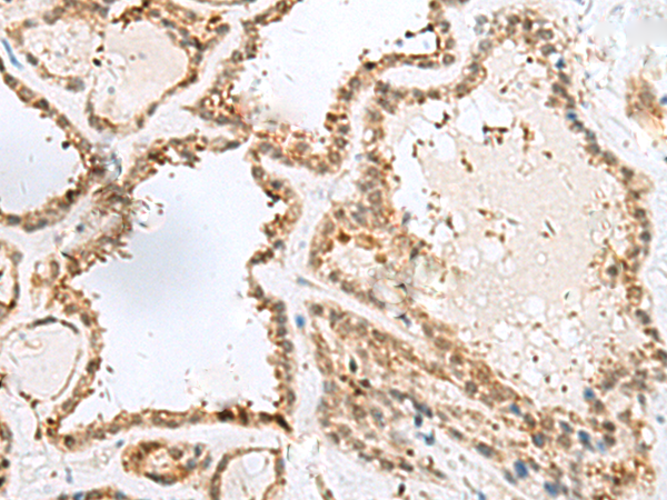ECD Antibody[47313]