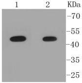 Pygopus 2 Antibody[48229]