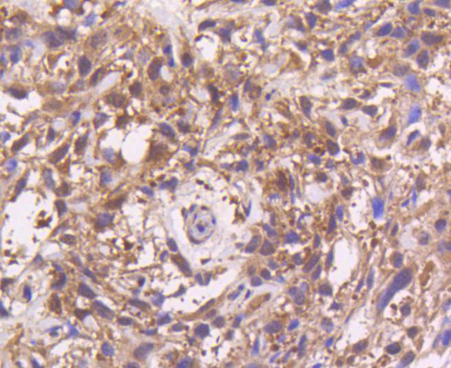 MEK3 Rabbit mAb[49128]