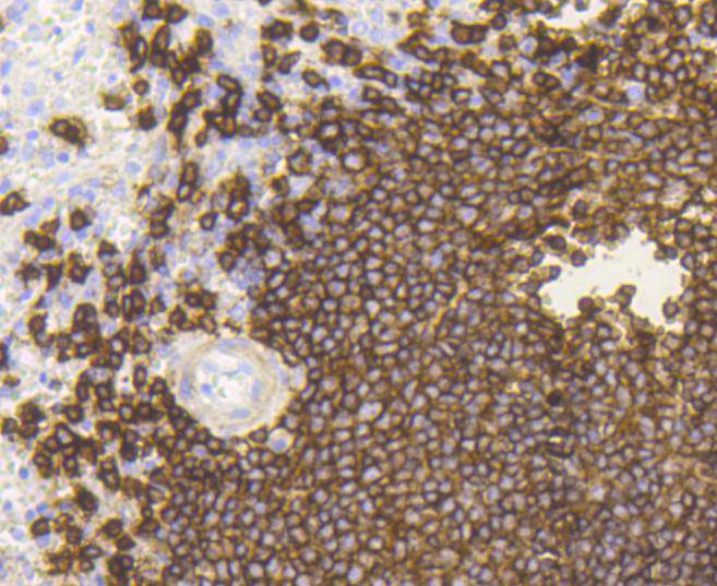 CD20 Rabbit mAb[48726]