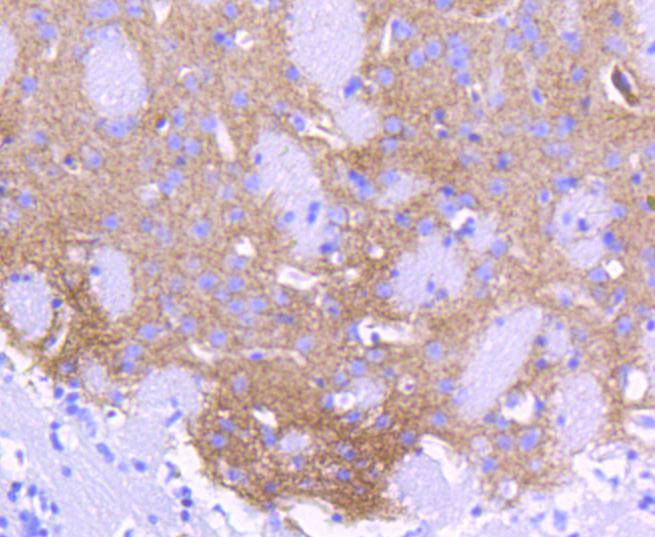 ALDH1A1 Rabbit mAb[48723]