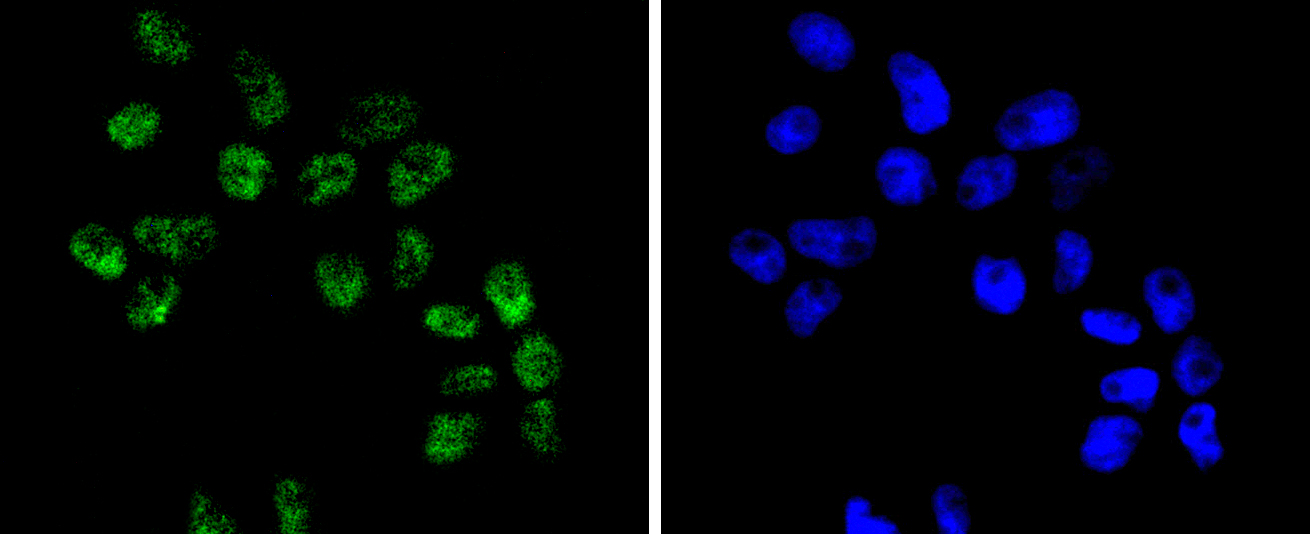 BRG1 Rabbit mAb[49101]