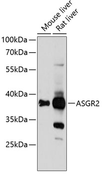 ASGR2 Polyclonal Antibody[2841