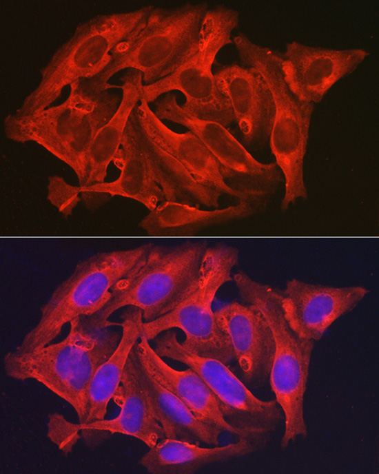 DAPK2 Polyclonal Antibody[3146