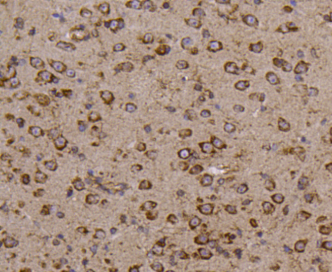 Metadherin(LYRIC) Antibody[482