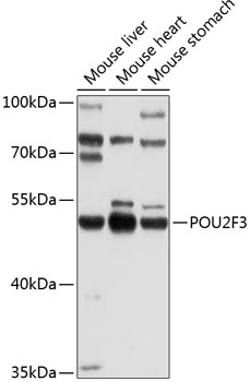 POU2F3 Polyclonal Antibody[272