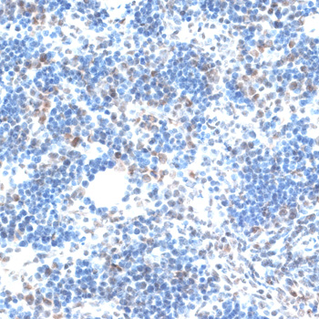AQR Polyclonal Antibody[30691]