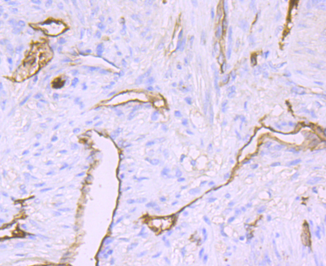 Claudin 5 Rabbit mAb[49471]
