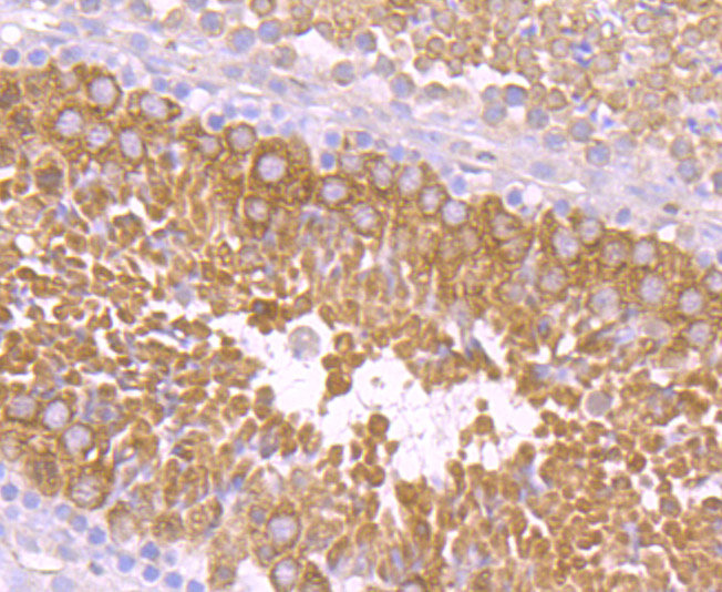 PIWIL1 Rabbit mAb[49759]