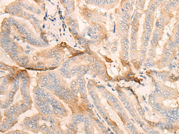 GDI2 Antibody[47126]
