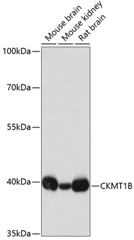 CKMT1B Polyclonal Antibody[304