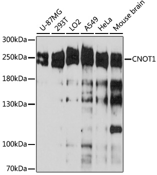 CNOT1 Polyclonal Antibody[3068
