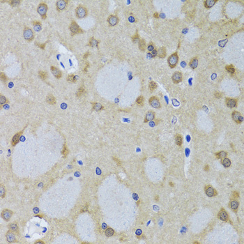 YWHAZ Polyclonal Antibody[3099