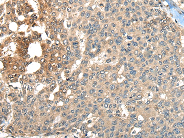 MAPK4 Antibody[46605]