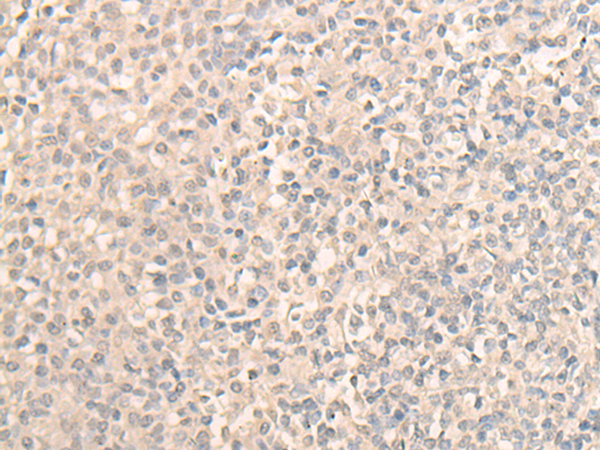DDX59 Antibody[47043]