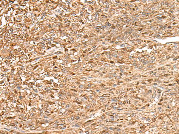 ZC3H7A Antibody[47283]