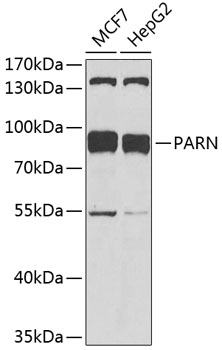 PARN Polyclonal Antibody[30511
