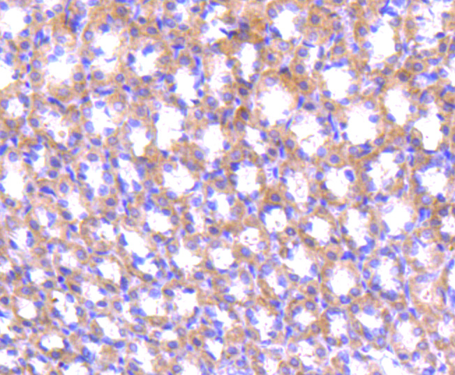 ABCF1 Rabbit mAb[49078]