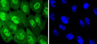 Phospho-EGFR(Y1068) Rabbit mAb