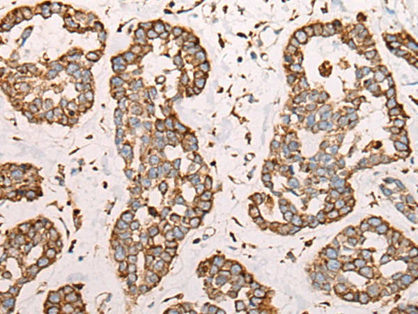 CAPN9 Antibody[46401]