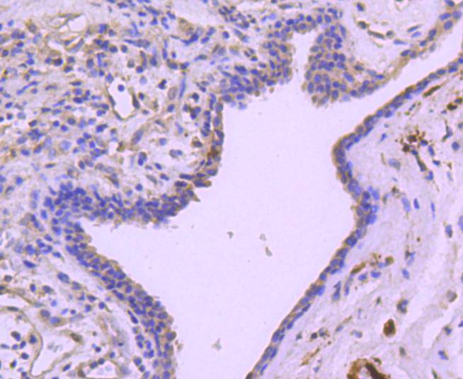 Phospho-Hsp27(S78) Rabbit mAb[