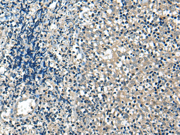 USP12 Antibody[46696]