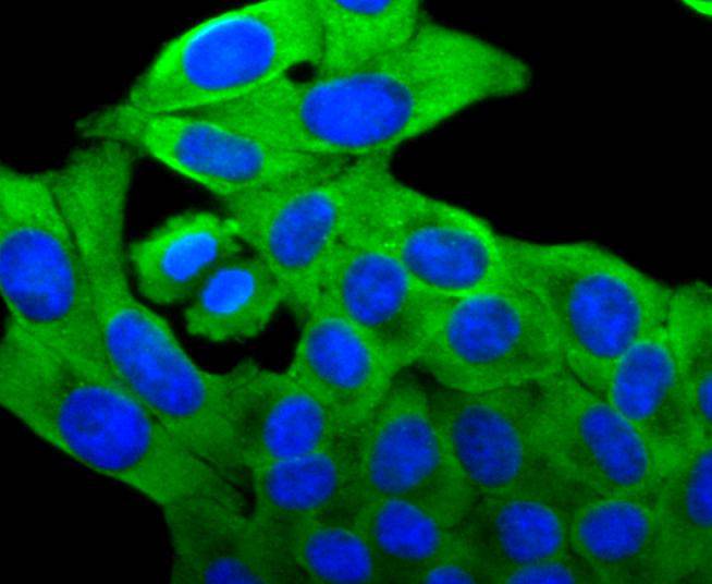 FOXO4 Rabbit mAb[49279]