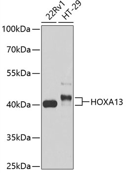 HOXA13 Polyclonal Antibody[284