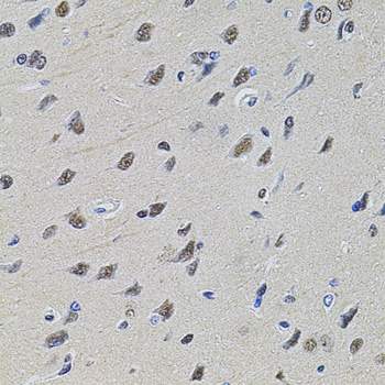 SET Polyclonal Antibody[29117]