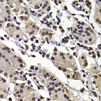 DNAJB6 Polyclonal Antibody[308