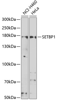 SETBP1 Polyclonal Antibody[308