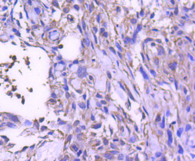 STAT6 Rabbit mAb[48795]