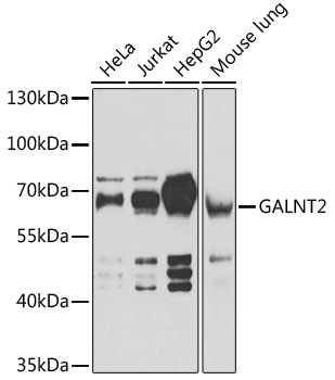 GALNT2 Polyclonal Antibody[307