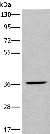 LDAH Antibody[46596]
