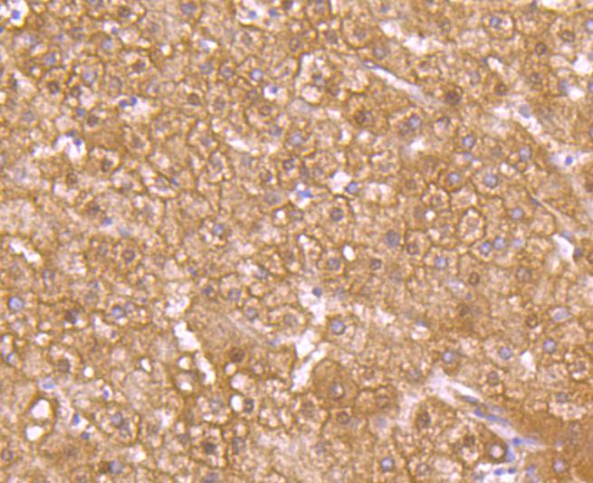 GLUT2 Rabbit mAb[49243]