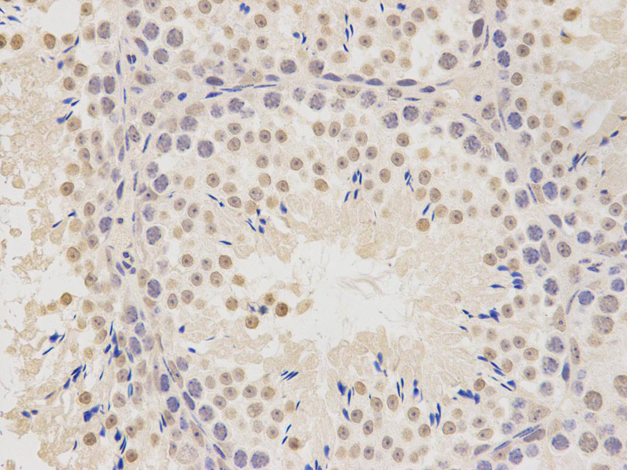 PTBP1 Antibody[48201]