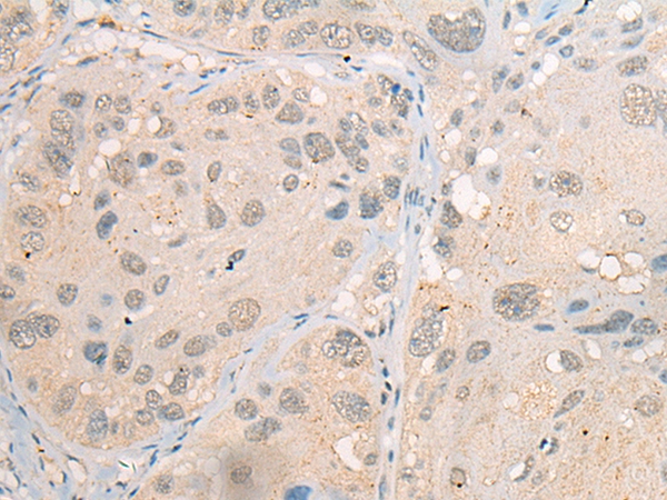 CDYL2 Antibody[46462]
