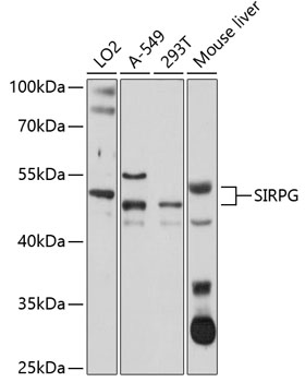 SIRPG Polyclonal Antibody[3061
