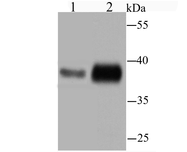 TMEM173 Rabbit mAb[49658]