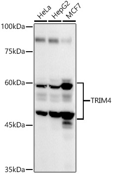 TRIM4 Polyclonal Antibody[2949