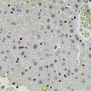 SET Polyclonal Antibody[29117]