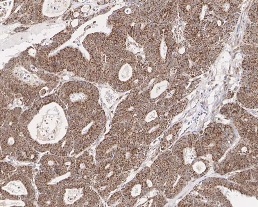 NUR77 Rabbit mAb[49510]