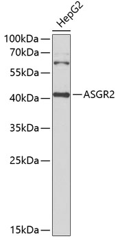ASGR2 Polyclonal Antibody[3071